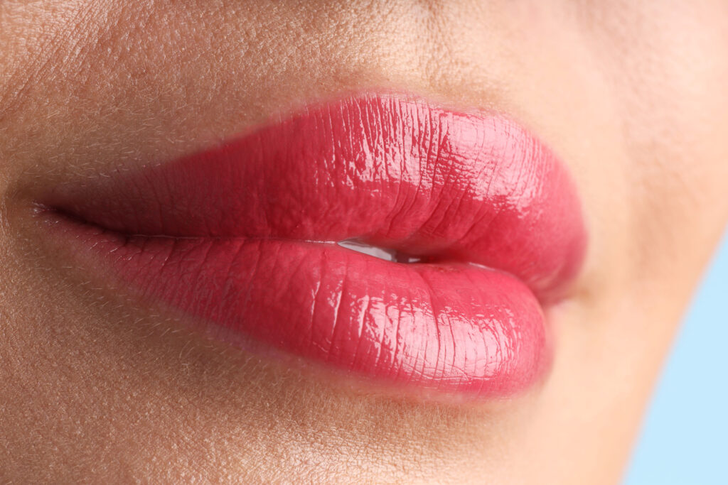 how long does swelling from lip injections last