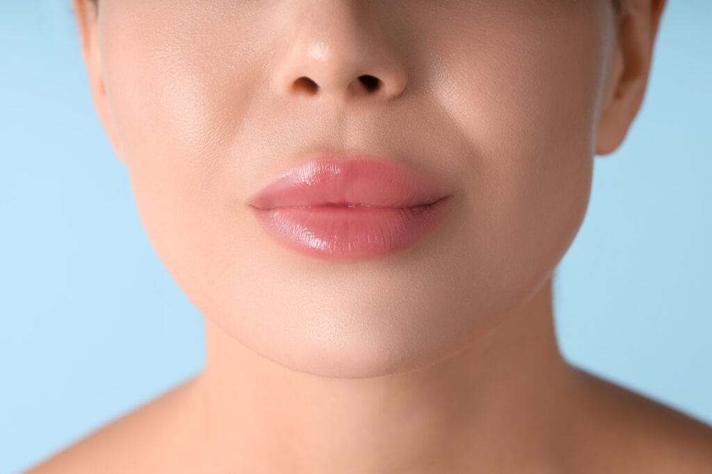 lip filler final results day 14 natural lips after swelling gone