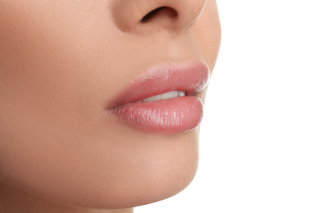 lip filler swelling day 1 immediate swelling after injection lips