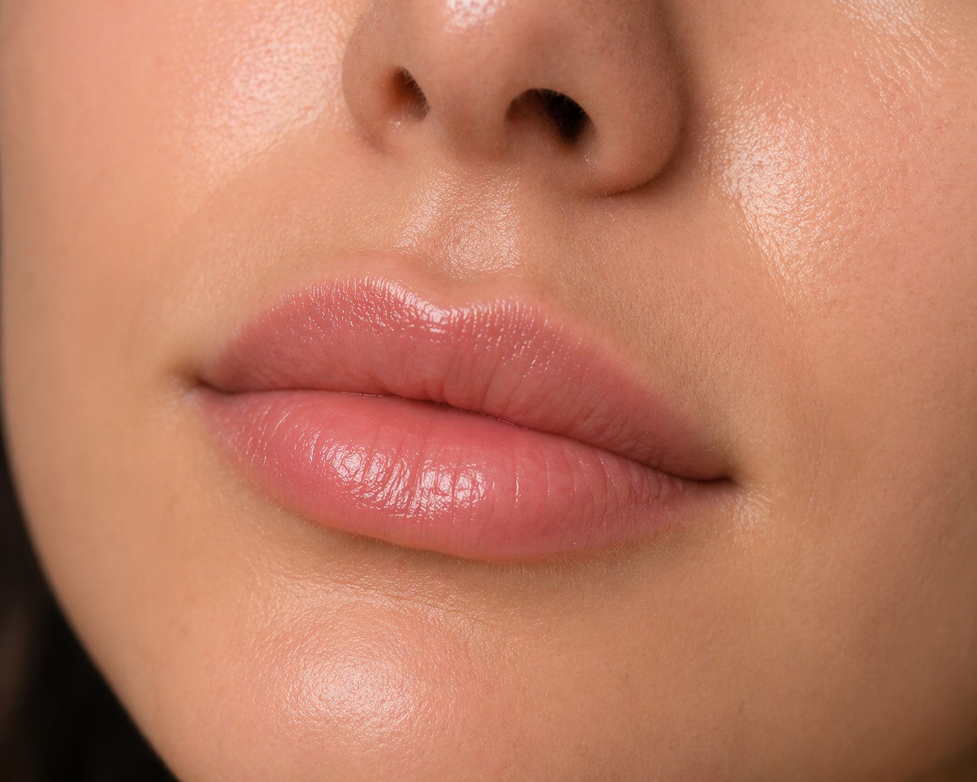 natural half syringe lip filler results subtle enhancement close up