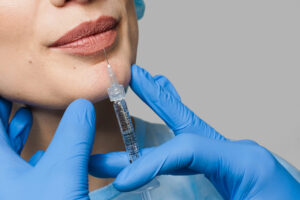 restylane lip filler cost per syringe chart