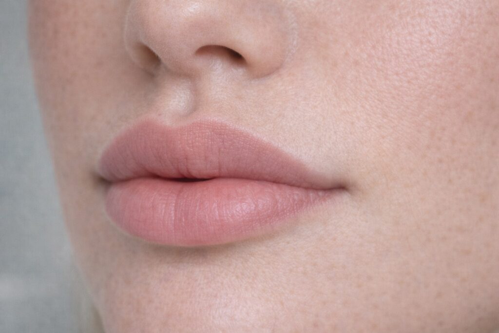 russian lip filler close up showing defined cupid bow flat upper lip structure natural texture detail