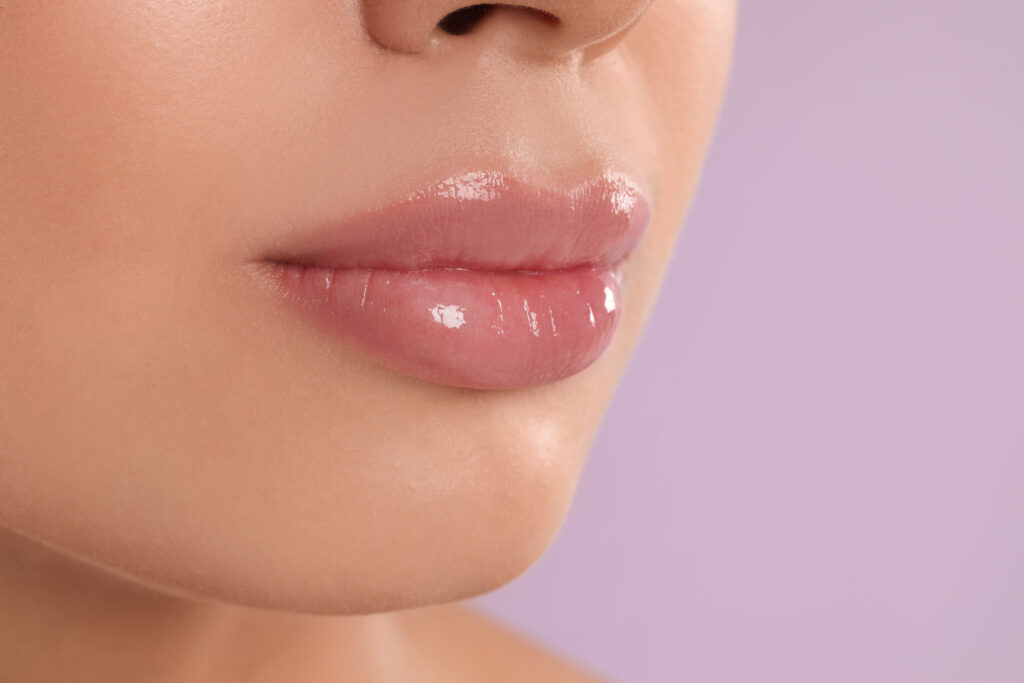 swelling after lip filler
